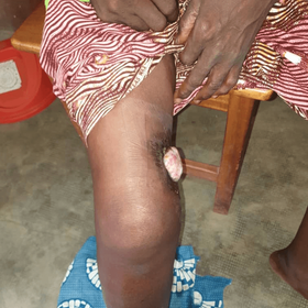 ONG HOP BÉNIN( HUMANITÉ OBLIGE PARTAGE)