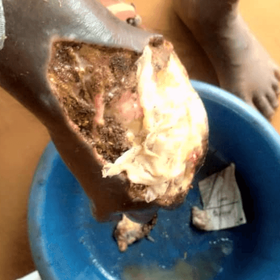 ONG HOP BÉNIN( HUMANITÉ OBLIGE PARTAGE)